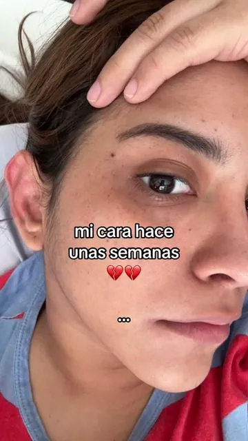 Replying to @dyqchsfs07jo compartiendo mi experiencia! #antiedad #cremarejuvenecedora #skincare #pielbonita 
