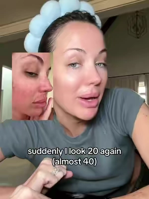 Korean skin tech literally says hi from the future  #medicube #eyecream #darkcircles  #koreanskincare  