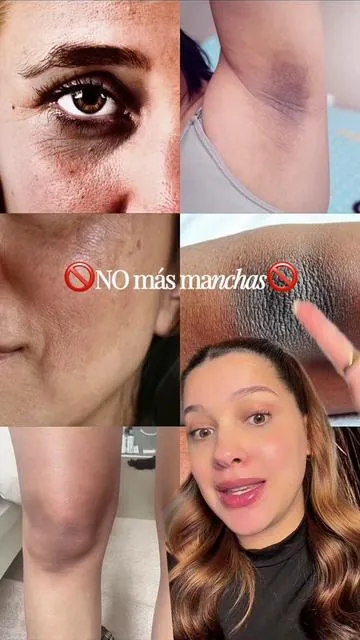 Adiós a las manchas en la piel y ojeras muy marcadas 🥹✨ @Arencia 🤍 #arencia #vitaminc #boostershot #botoxserum #WeeklyDeals 