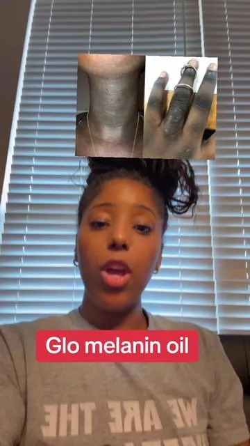 Glow melanin is a African owned business and it’s perfect to tell what this company do considering that it is Black History Month#glomelanin @✨ Glo Melanin ✨ #bodyoil #hyperpigmentation #turmeric 