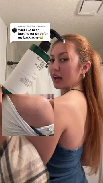 Replying to @EDWIN Korean brands are amazing 😩😍 #acne #bodyacne #insecurity #bacne 