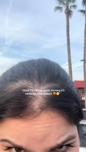 🥹🙌🏻🙌🏻🙌🏻 #drgroothairthickeningshampoo #drgroot #hairgrowthjourney #hairthinning #thickeningshampoo 