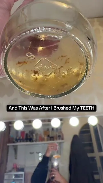 This mouthwash shows you what brushing misses and it's horrifying!! Visible build-up lifted, fresher breath, and dentist-level whitening with hydrogen peroxide. One rinse and you'll never skip this step again. @Hismile US  #whiteteeth #hismile #mouthwash #teethwhitening #newproductalert 