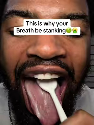 If someone’s breath is kicking it’s because they don’t clean their tounge #fyp #bodyaccel #toungecleaner #oralhealth #badbreath 