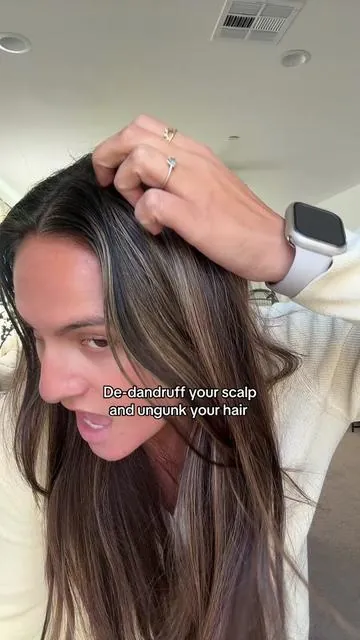 The flakes are just not giving. I finally got sick of my dandruff not being cute and figure out how to stop my scalp from being itchy and flaky! #flakyscalp #itchyscalp #dandruff #dandruffremoval #dandruffsolution 