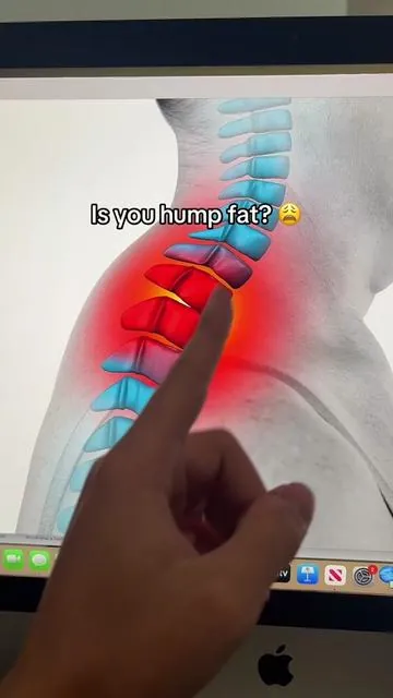 Relieve the tension in your neck and spine! #neckpain #kyphosis #badposture #neckpainrelief #tiktokmademebuyit 