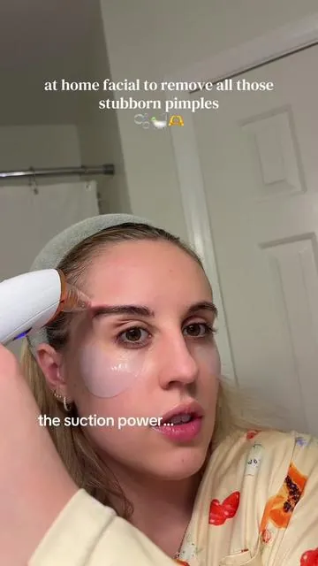 it’s going to get alllll those stubborn pimples and clean those pores!! #blackheadextractor #blackheadremovertool #athomefacial #skincare 