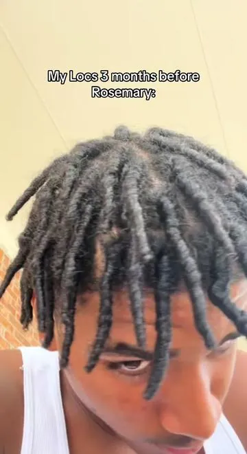 Rosemary works fr!!#fyp #hairproduct #hairgrowth #hairgrowthjourney #rosemaryoil 