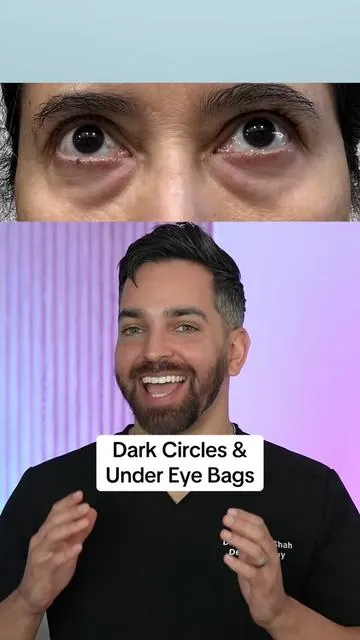 Dark circles and under eye bags, we finally have a REMEDY @Remedy Science 