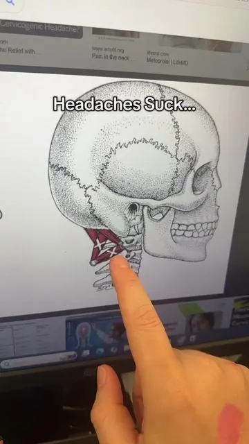 Headaches are the worst! This is the peanut massage ball that i use to do a Suboccipital release. This is not medical advice, this is just what works for me. #headache #headacherelief #migrainerelief #migraine #headaches 