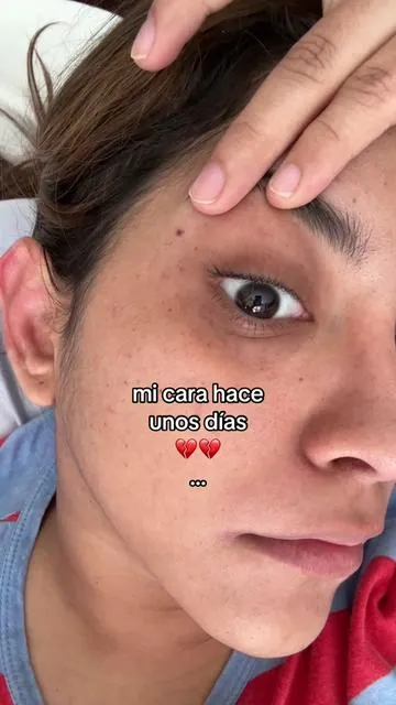 pase de 35 a 18 ya dejen al toxico #skincare #amtiedad #cremareafirmante #glowup #pielbonita 