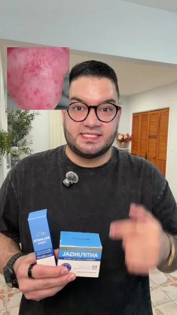 Habías escuchado acerca de la balanitis ? #balanitis #balanitisawareness #menshealth #hermonbalanitis #tiktokshopjumpstartsale 