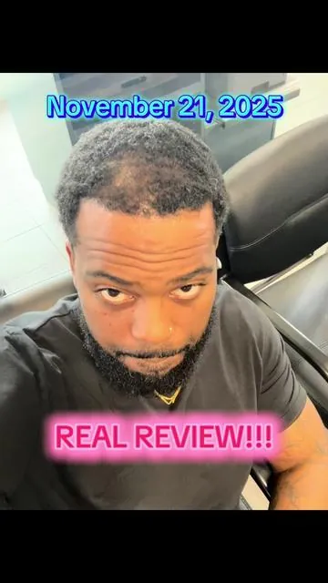 In these 11 weeks my hair has made major progress using The Ordinary: Hair density serum. This is a REAL REVIEW so if you’re asking me if it really works…IT DOES. You can go to my page and see my har journey for yourself. Get yours today 🙌🏾 #TheOrdinary #hairgrowthtips 