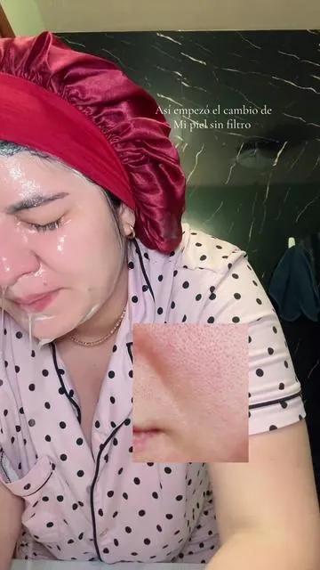 Yo amoooo este jabón piel grasosa mi cambio cuida tu rostro vale la pena probarlo chicas y el precio está en oferta #skin1004  #madagascarcentellaasiatica #skin #tendencia#tiktokshopcreatorpicks  