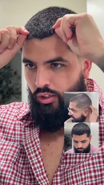 Rutina de todas las noches para mejorar la densidad de mi cabello y volver a dejarlo largo  • un shampoo para limpiar el cuero cabelludo y luego cuando salen de ducharse el tópico y así todos los días, no hace falta que se duchen, si prefieren hacerlo en otro momento lo hacen o si prefieren aplicarse solo el tópico, la pomada es un plus o tip adicional para también peinarnos y estimular el crecimiento  #hairgrowth #thinninghair #hairgrowthtips #nanoxidil #hairlosstreatment 