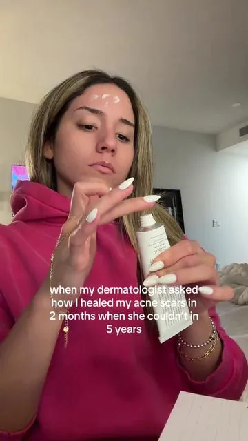 my skin feels so free without them! #skintok #Glowyp #skincare #acnescars 