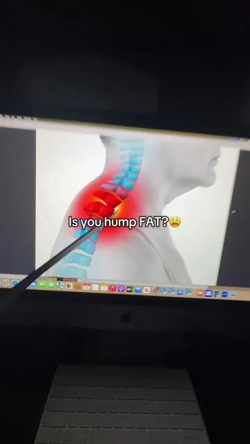 Relieve the tension in your neck and spine! #neckpain #kyphosis #neckpainrelief #badposture #tiktokmademebuyit 