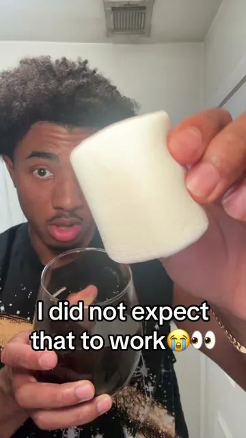 Wow….Just wow!#tiktokshopcreatorpicks #whiteningstrips #yellowteeth #teeth #drdent 