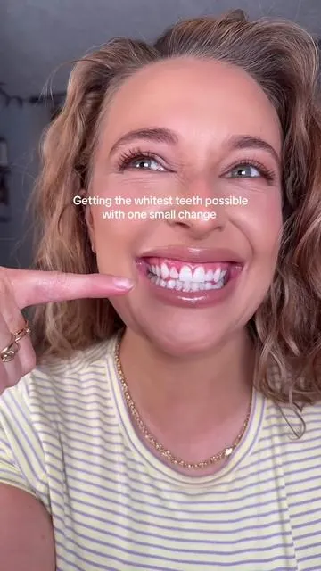 Thank you for my new smile @Lumineux #whiteteeth #nasa #lumineux #smile 