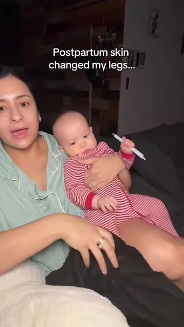 Postpartum skin hits different… nobody warned me my legs would change after kids. This oil has become part of my quick after-shower routine and my skin feels so much smoother and more hydrated. Moms who don’t have time for complicated routines will understand this one. Affiliate link — I may earn a commission. This is not medical advice. Results may vary. @M3 Naturals  #p#postpartummomsm#momskincarem#momswhogetitc#cellulitecaremillennialmomlife