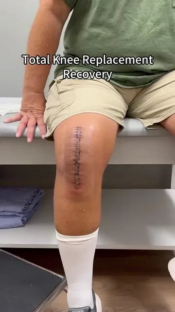 My family loves this knee massager#xpolar #kneereplacement #kneepainrelief #kneemassager #kneereplacementrecovery