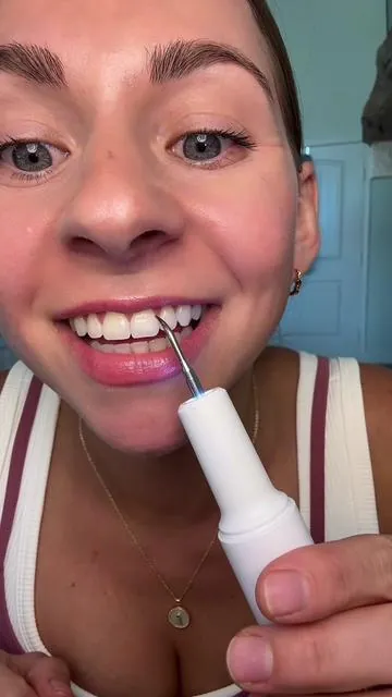 My favorite teeth cleaning tool!!! #plaqueremover #teeth #teethcleaning 