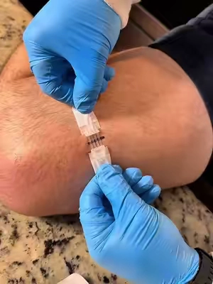 Have you ever seen a band close a wound like this?! @SurviveX #homefirstaidkit #firstaid #woundcare #firstaidessentials #tiktokshopcreatorpicks 