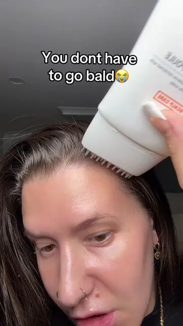 One of the cleanest and best hair growth products I've came across💯 #hairloss #hairgrowth #scalpcare #scalppsoriasis #thinninghair these are opinions always do your own research results may vary