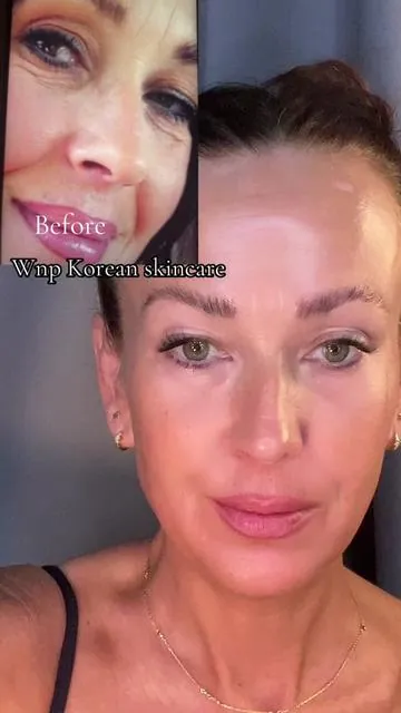 @WNP.Skincare#skincare#koreanskincareroutine 