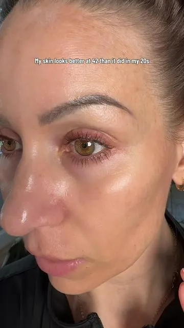 Your skin will look smoother than it’s ever been. #glycolicacid #drmtlgy #unevenskintone #glowingskin 