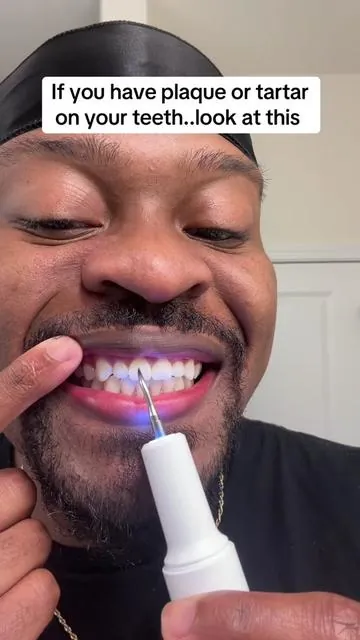 If you have plaque or tartar on your teeth..look at this. You can get more details about this if you tap the cart button on the video. #teeth #plaque #tartar 