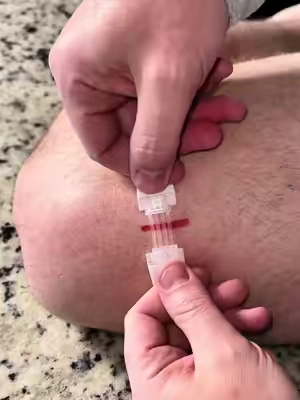 @SurviveX zip wound closure kit. #scarsolutions #homefirstaidkit #firstaid #survival #tiktokshopspringglowup 