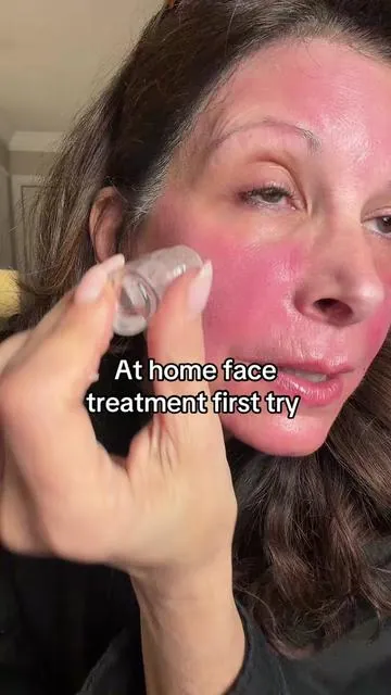 Wow I’m loving the results!! #seranova #microinfusion #tiktokshopcreatorpicks #TikTokstockup Disclaimer: Price or gift may Vary After promotion ends Prices and deals may vary from account to account so check the most accurate price of the day from the orange shopping cart link. 
