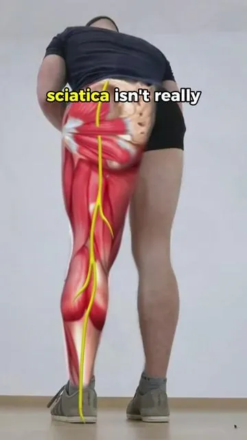 Most sciatic nerve pain is caused by spinal compression,this is what actually helps#decompression #backpain #sciaticarelief #sciaticapain #lowerbackpain #backmassage 