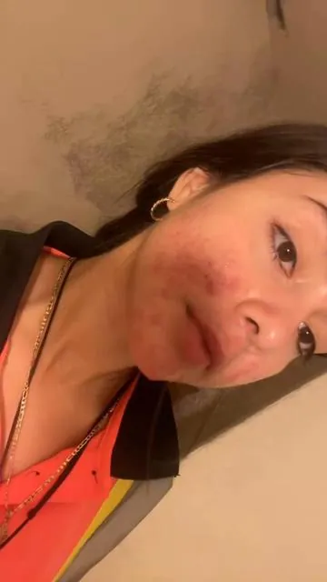 Mi piel cambió cuando dejé de adivinar y empecé a tratarla bien ✨ @anua_global #acne #skincare #azelaicacid #anua #GlowUp