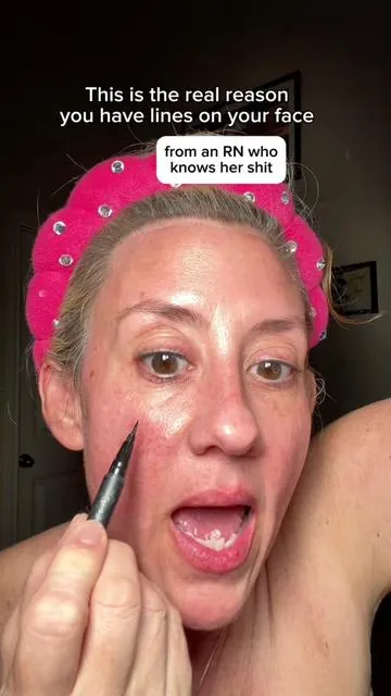#skincare #wrinkles #facelines @zzsleeptape 