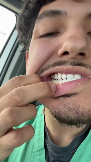 Wow I was not expecting that. Whitening toothpaste!! #teethwhitening #teeth 