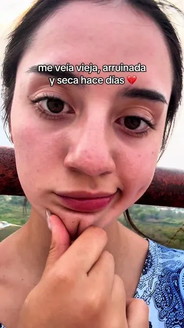 Se los juro que parezco otra persona ! Estoy en shock !!!  #skincarecoreano #koreanskincare #kbeauty #ojeras #manchasenlapiel 
