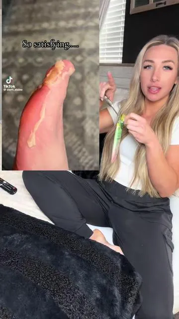 Only cute feet this summer! ☀️🎀 #footpeelmask #feetcare #footcareroutine #callusremoval #summerhacks 
