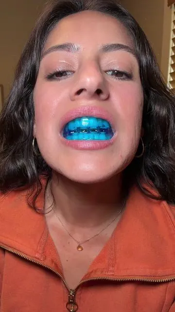 Mouth breathing is aging you slowly with time ! You need a mouth guard to put your jaw forward and into the correct position! Feel more rested and no headaches #mouthbreather #tmjtreatment #jawlinecheck #teethgrinding #mouthguards 