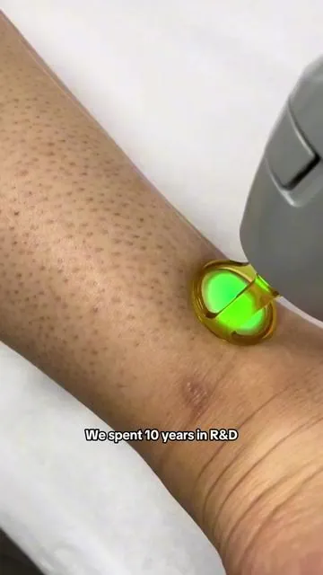 🤯 How Ulike IPL Works? Science-Backed Hair Removal Explained in 60 Seconds! #Ulike#UlikeDaretoGlow #UlikeAir10#UlikeHairRemoval#UlikeSpring#hairremoval