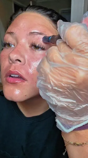 Microneedling at home?! I was so scared to do this but it wasn't bad AT ALL. I'm a diy girlie. I didn't have numbing cream and the pain level was a 2 out of 10. Not bad at all! My skin is much more red in person than the camera picks up but it isn't too sore. it feels like a bad sunburn. They say tattoos are therapeutic... Well so was this 🤣 #microneedling #microneedlingtherapy #drpen #diygirlie #imjustagirl 