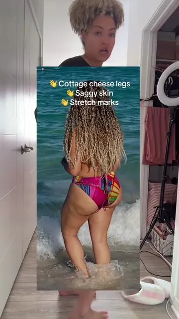 Bye bye cottage cheese legs 👋  #cellulite #cryothermalgel #saggyskin #stretchmarks #glowup 