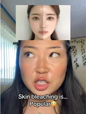 #hyperpigmentation #brightening #kbeautyproducts #glutathione #injection 