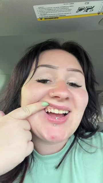 #remineralizinggum #remineralizeyourteeth #tiktokshopstockup #toothdecay 