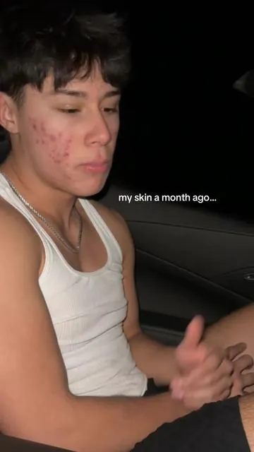 Go give it a shot! #skincare #pores #skintific #acne 