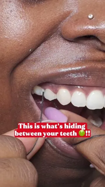 Brushing alone won’t fix bad breath 😬 Burst Expanding Floss gets all the gunk your toothbrush misses! It comes in multiple flavors, so grab yours today! Linked below👇🏾  #burstfloss #flossyourteeth #freshbreath #gingivitis #gumdisease 