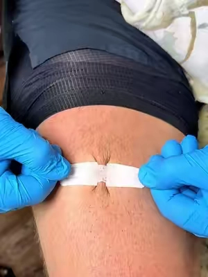Zip wound closure kit you can keep at home or on the go! @SurviveX #callusremover #scarsolutions #pimplecoverup #firstaid #tiktokshopcreatorpicks 