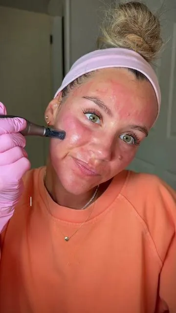 How to Microneedle 💉✨ step x step safely at home as a beginner WITH full aftercare routine I follow! Let me know if you have any questions! All products 🔗 in my TT showcase + Amz storefront 👆🏼⁣ @Ki Cosmetics  ⁣ Post Treatment Favs 🤍 ⁣ @Prequelskin  • Glycerin Cleanser ⁣ • Multi Peptide Serum ⁣ • Am/Pm Moisturizer ⁣ • Half & Half Peptide Moisturizer  ⁣ @Naturium  • Dew Glow SPF 50 ⁣ @luyorsofficial  • Red Light Therapy Mask ⁣ ⁣ #microneedling #skintreatment #acnescars #antiagingtips #tiktokshopcreatorpicks 