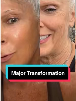 At 62, I’m living proof that you can physically lift your features without surgery. My jowls are tighter, my cheeks are higher, and even my brows have lifted after staying consistent with my @INIA BeautyCraft Flare routine. Grab the Flare at the link on this video and start your own transformation! #snatched #matureskin #biohackqueen  #creatorsearchinsights 